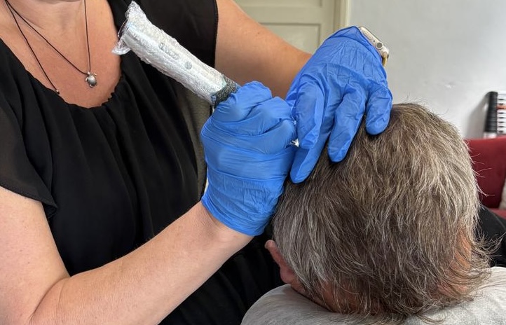 Hair Tattoo Oosterhout, volume behandeling na een te dun uitgevallen haar transplantatie. 
